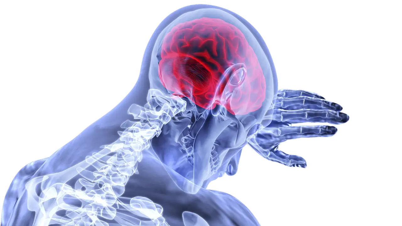 Illustration of Stroke showing brain inflammation